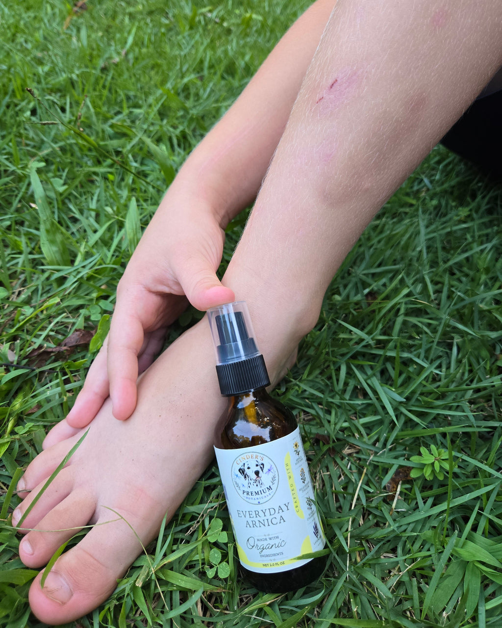 Everyday Arnica